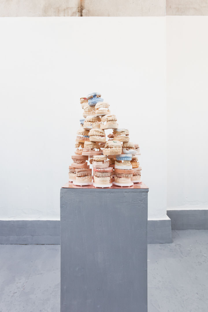 VÉKONY Dorottya: Részlet a Szájterpesz című sorozatból / from series Mouth Spreader, 2018